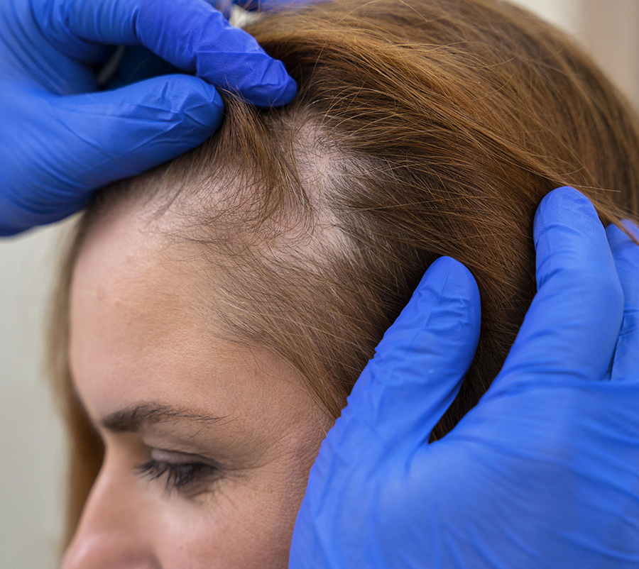 Asesoramiento farmacéutico para la caída del cabello en Farmacia Domingo.